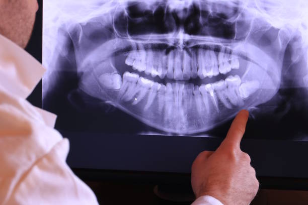 Best Dentist for Severe Toothache  in Crystal Lawns, IL